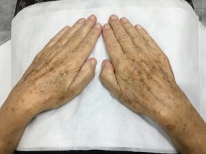 Hands_Before