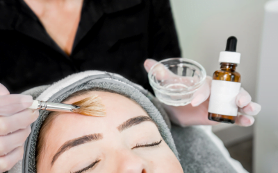 Chemical Peel Myths Debunked