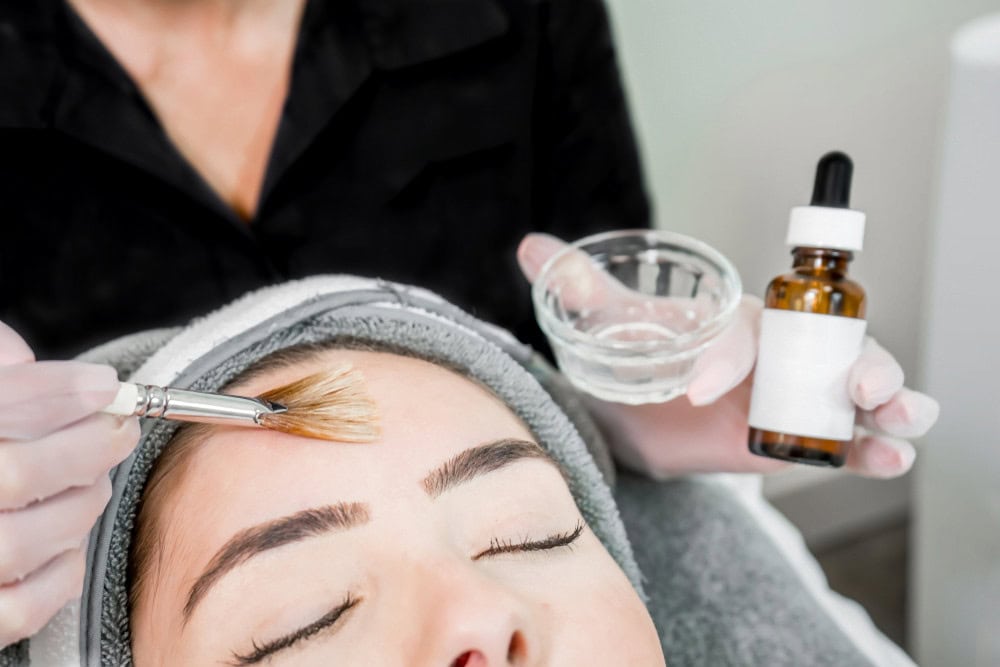 Chemical Peel Myths Debunked