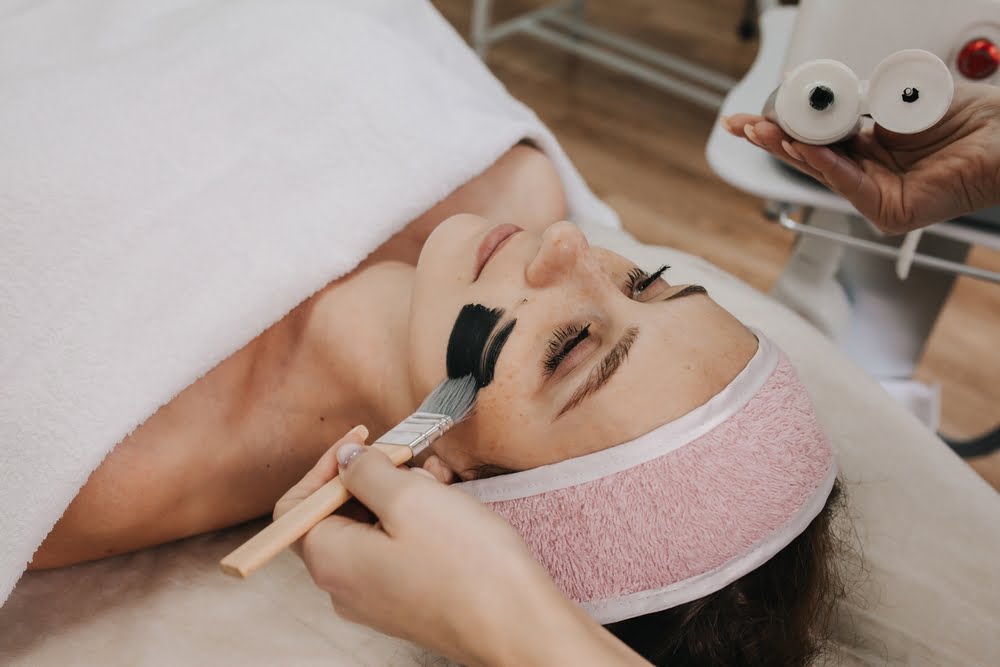 A Complete Guide to Carbon Laser Peel Treatment