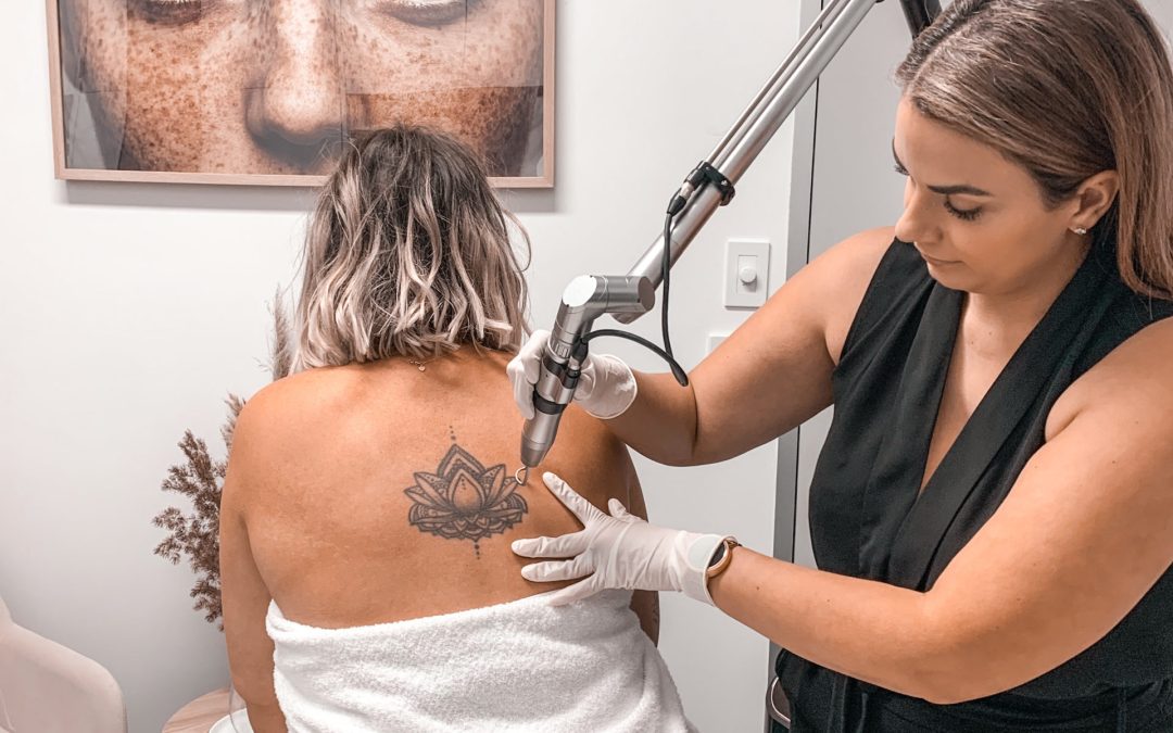 Eliminate those regrets, and find out how laser tattoo removal works