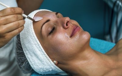 Exclusive look into Chemical Peels