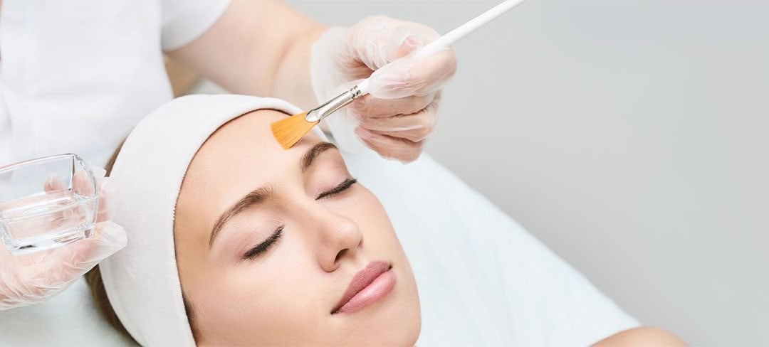What is a Chemical Peel Used for?