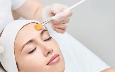 What is a Chemical Peel Used for?