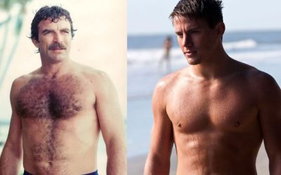 Laser Hair Removal Options for Men