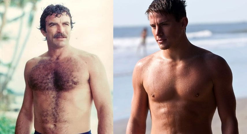 Laser Hair Removal Options for Men