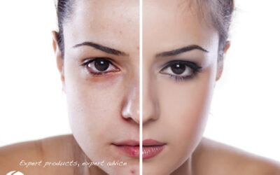 Top 5 Make up tips – Learn from the experts in skin care!