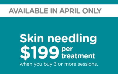 What’s the difference between ‘At Home’ & clinical dermal rollers?