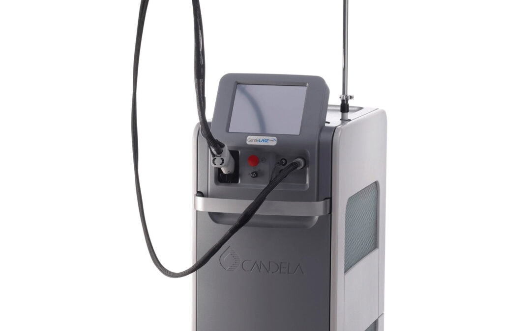 Risks and Side Effects of Laser Hair Removal