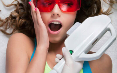 The dangers & risks of at home IPL hair removal devices