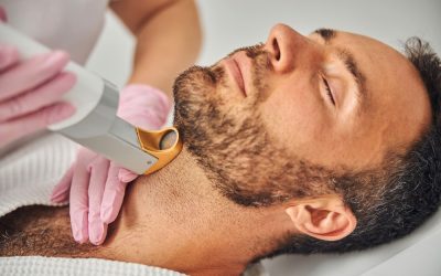 Facial Laser Hair Removal – Your Questions Answered