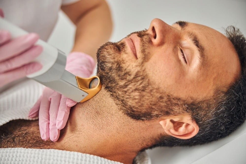Facial Laser Hair Removal – Your Questions Answered