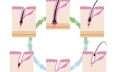 Can you tell the difference between pimples and ingrown hairs?
