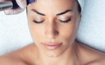 Benefits of Skin Needling