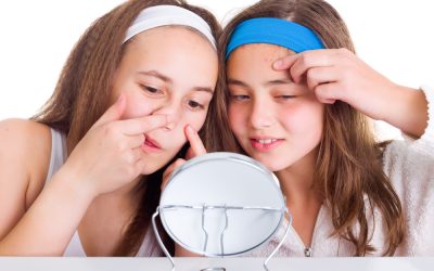 Teenage Skin: A Parents Guide To Treating Acne In Teens and Kids