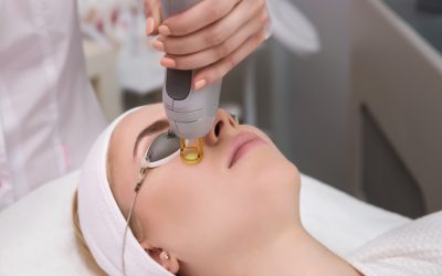 Why Timing Matters in Laser Hair Removal — and Why We Do It Differently at VC Dermal Clinics