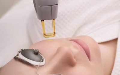 Laser Hair Removal in Berwick – The Best Time to Start for Summer Smoothness