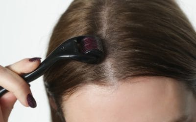 Skin Needling for Hair Loss — Does It Really Work? A Complete Guide for Anyone Struggling With Thinning Hair