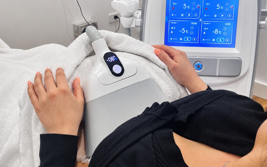 Introducing CoolSlimming Ultimate 360°: Advanced Fat Freezing Now at VC Dermal Berwick